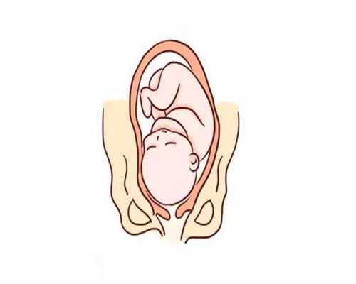 专业代生小孩_怀孕期间如何有效缓解浮肿？