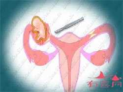 北京代孕联系电话_北京代孕助孕包成功