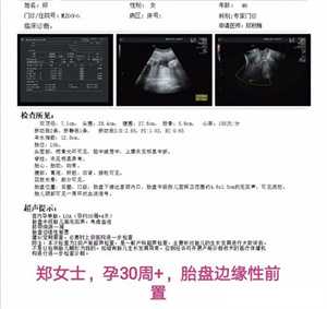 北京代孕产子要多少费用_北京代怀孕有什么要求