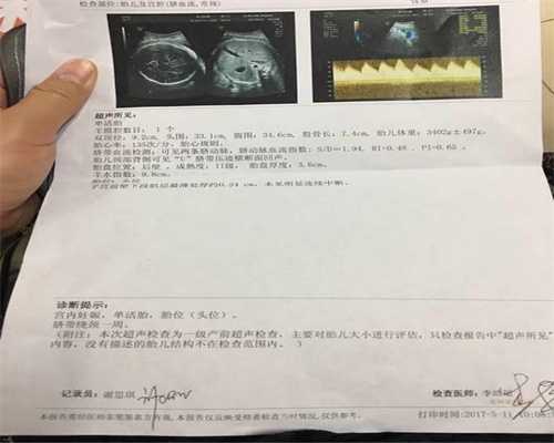 想私人代孕-北京代孕生儿子多少钱_【北京哪个医院做供卵试管】排卵9约19号，