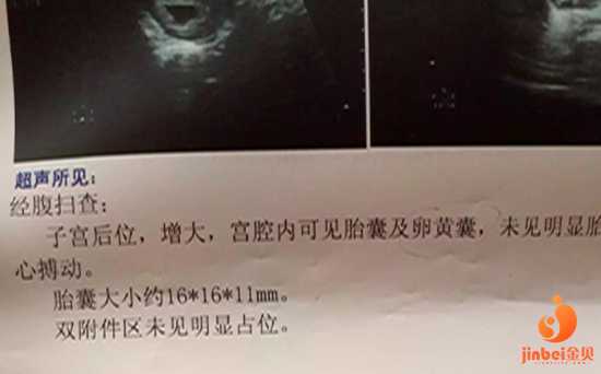 北京代孕哪家比较可靠-有没有女人愿意代孕_【北京有哪些可以做供卵的私立医